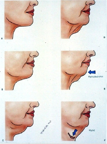 640 (1).png
